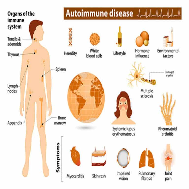 Autoimmune Diseases | ClearIAS